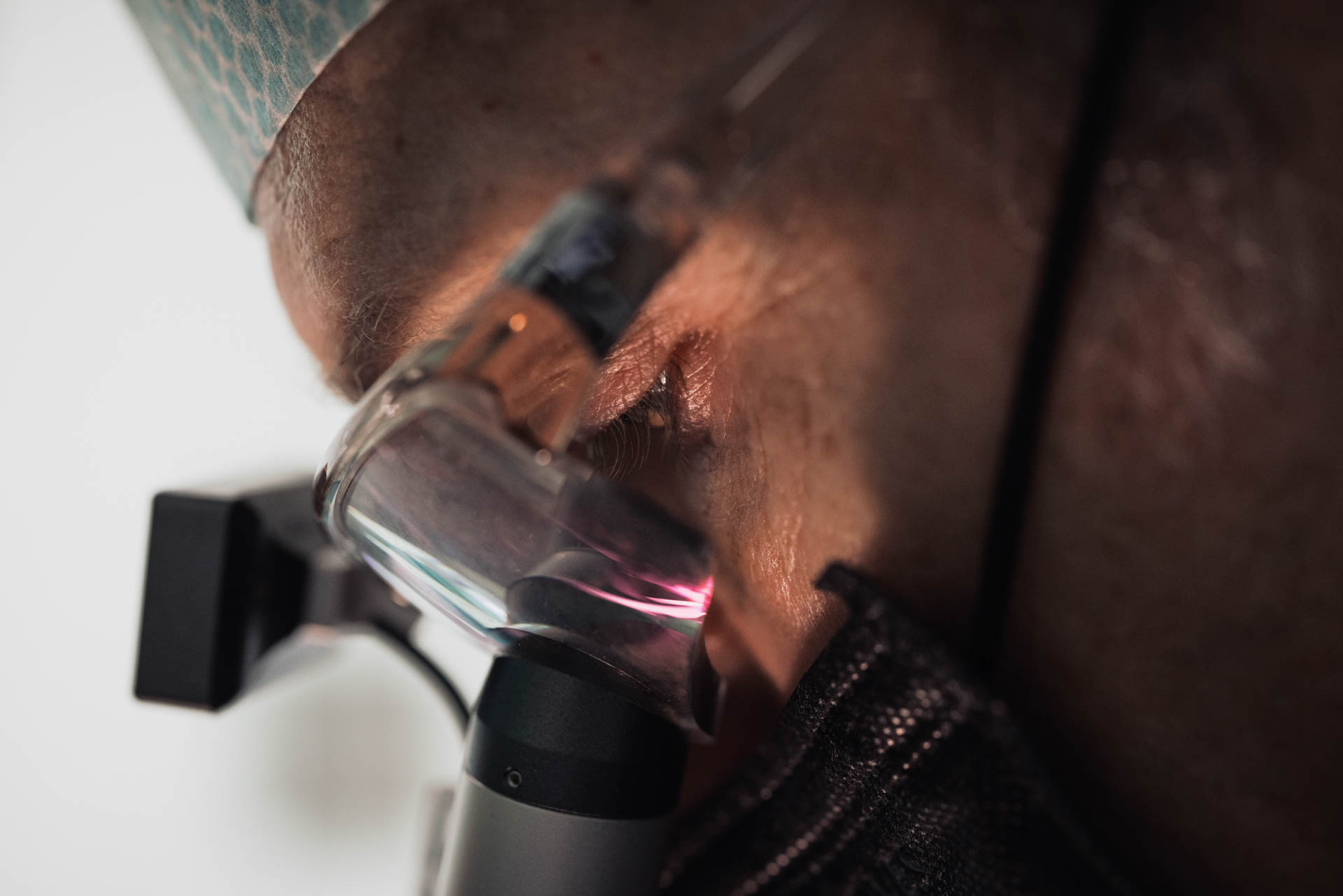 Detailaufnahme einer Hautbehandlung in der Stadtwald Klinik