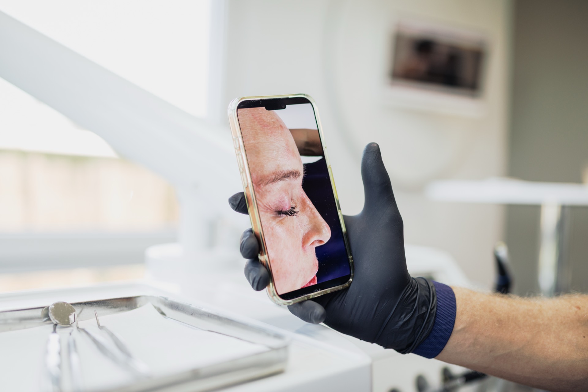 Digitale Profilanalyse zur Vorbereitung der Nasenkorrektur in der Stadtwald Klinik