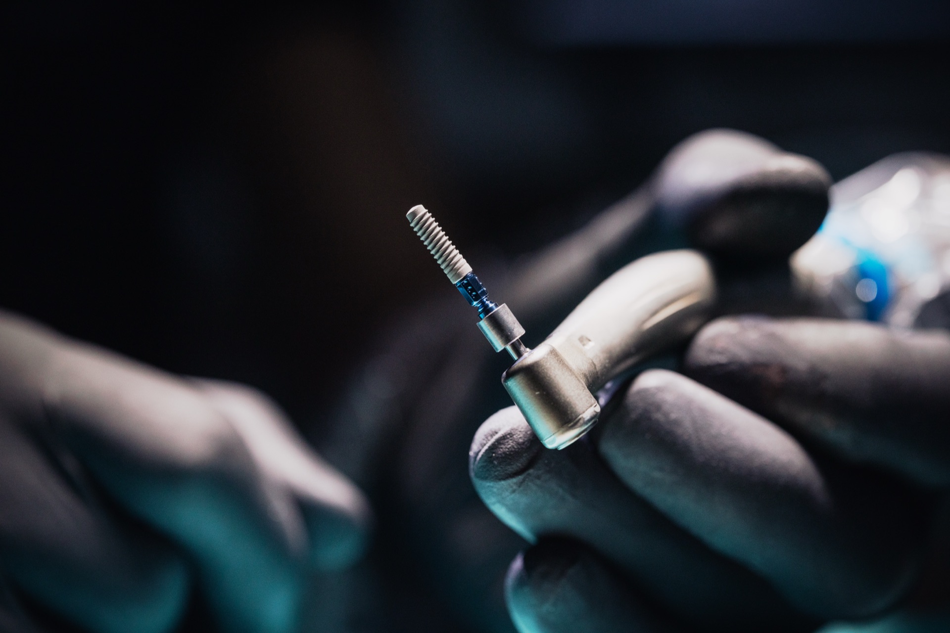 Anschauungsmodell einer Implantatversorgung in der Stadtwald Klinik