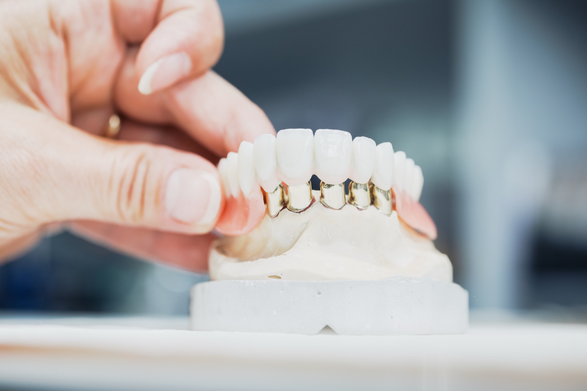 Fertiger Zahnersatz auf dem Modell im Dentallabor der Stadtwald Klinik