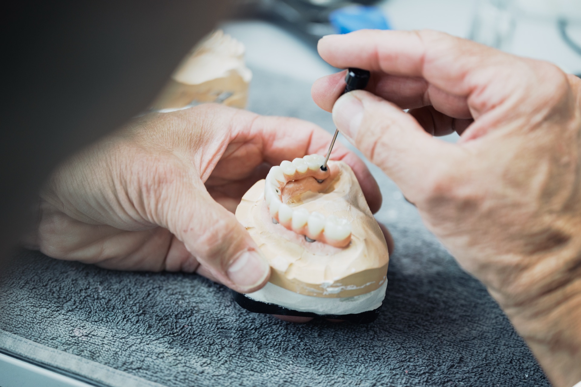 Präzisionsarbeit an einer Zahnersatz-Krone im Dentallabor der Stadtwald Klinik