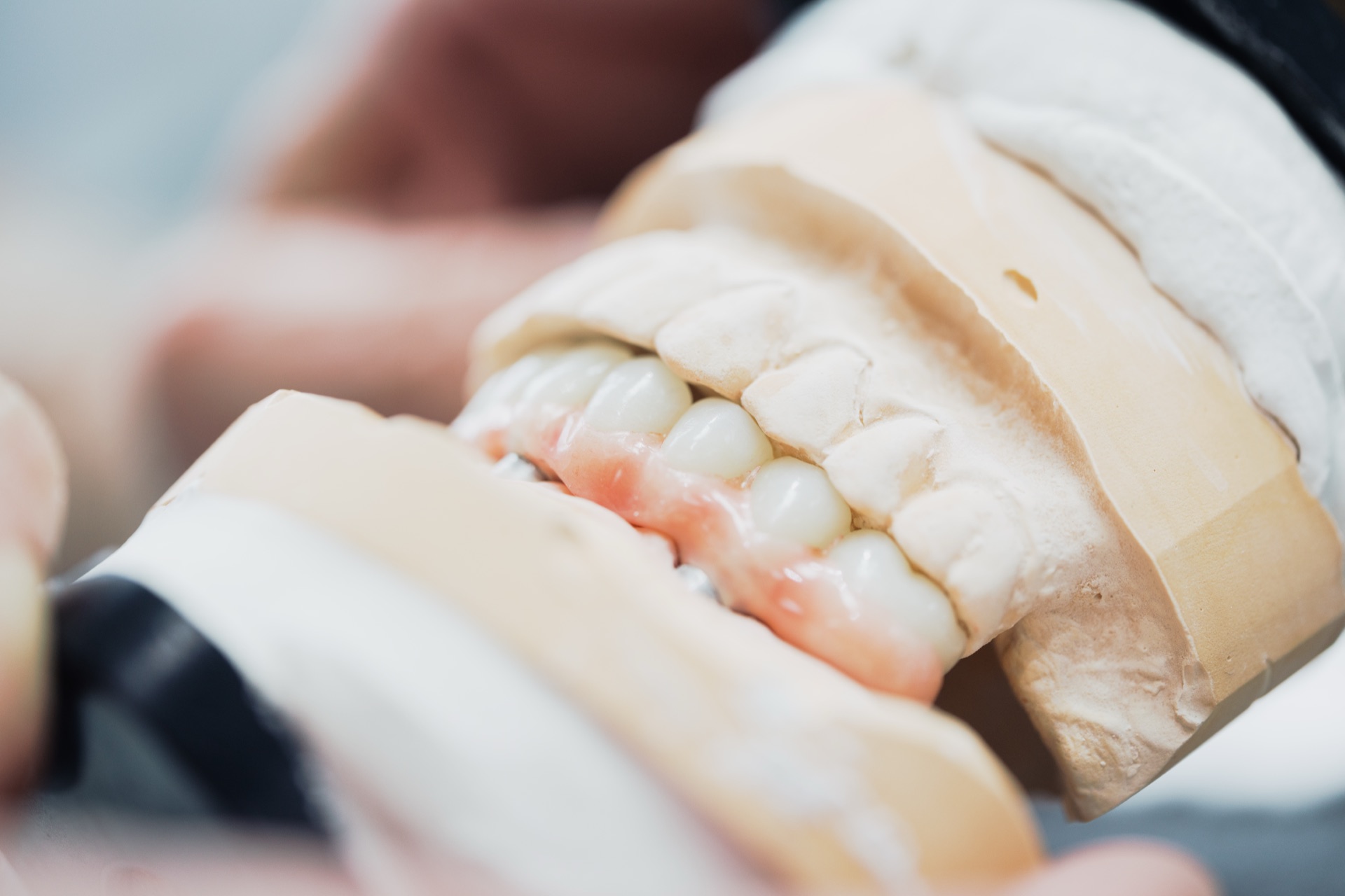 Zahntechnikerin bei der Arbeit im hauseigenen Dentallabor der Stadtwald Klinik